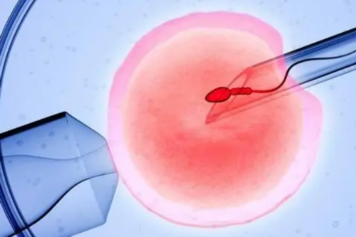 辅助生殖：试管婴儿成功率、费用及供卵策略深度解析