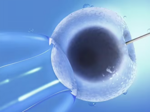 天津代生好吗,天津卵巢切除能做试管婴儿-正规试管供卵机构