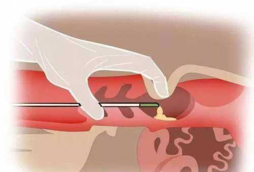 天津试管助孕：辅助生殖技术可行性与多维考量