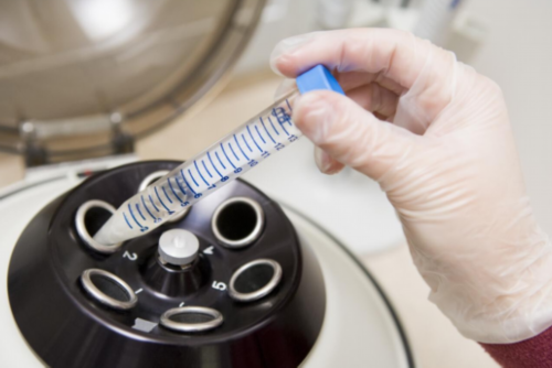 天津辅助代怀网,天津卵巢切除能做试管婴儿-正规试管供卵机构