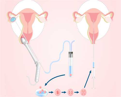 天津供卵代怀套餐,天津供卵三代试管婴儿多少钱(2026
天津全过程费用价格明细