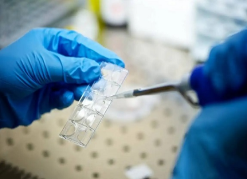 天津哪里有代生,天津供卵试管医院患者染色体平衡易位怎么办？