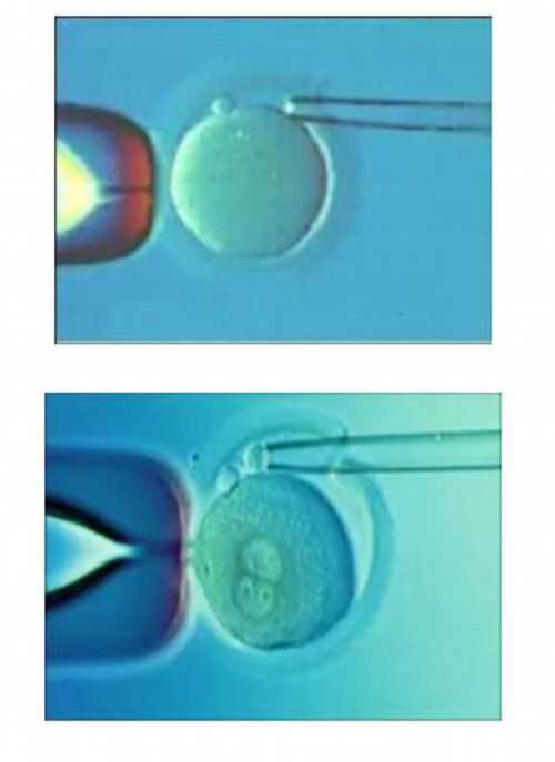 供卵试管助孕费用解析：辅助生殖流程与选择指南