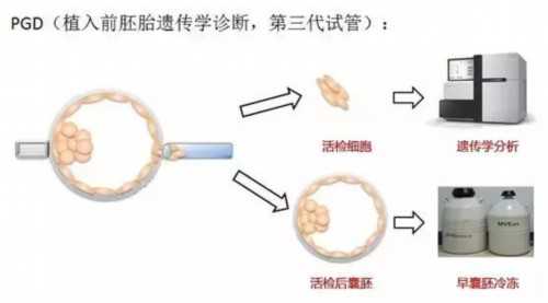 天津试管婴儿费用指南：助孕流程、成本分析与代怀/代生方案选择