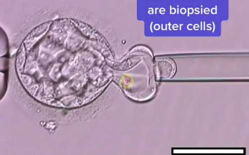天津试管助孕全攻略：供卵选男孩、卵巢切除患者试管方案与费用明细