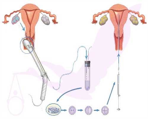 天津代妈代孕包成功,天津试管助孕医院哪家好，内含项目花费明细清单